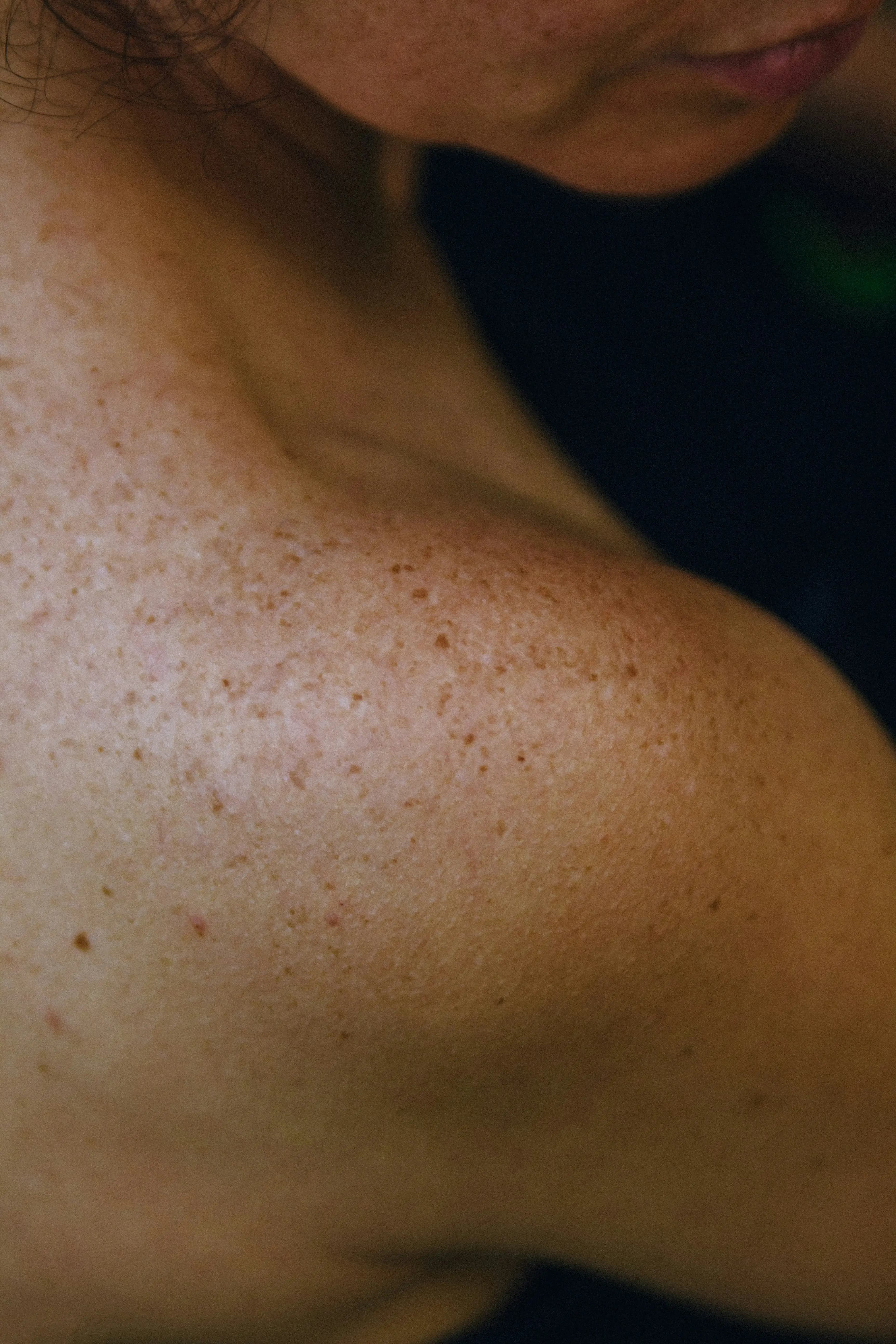 FOR SKIN